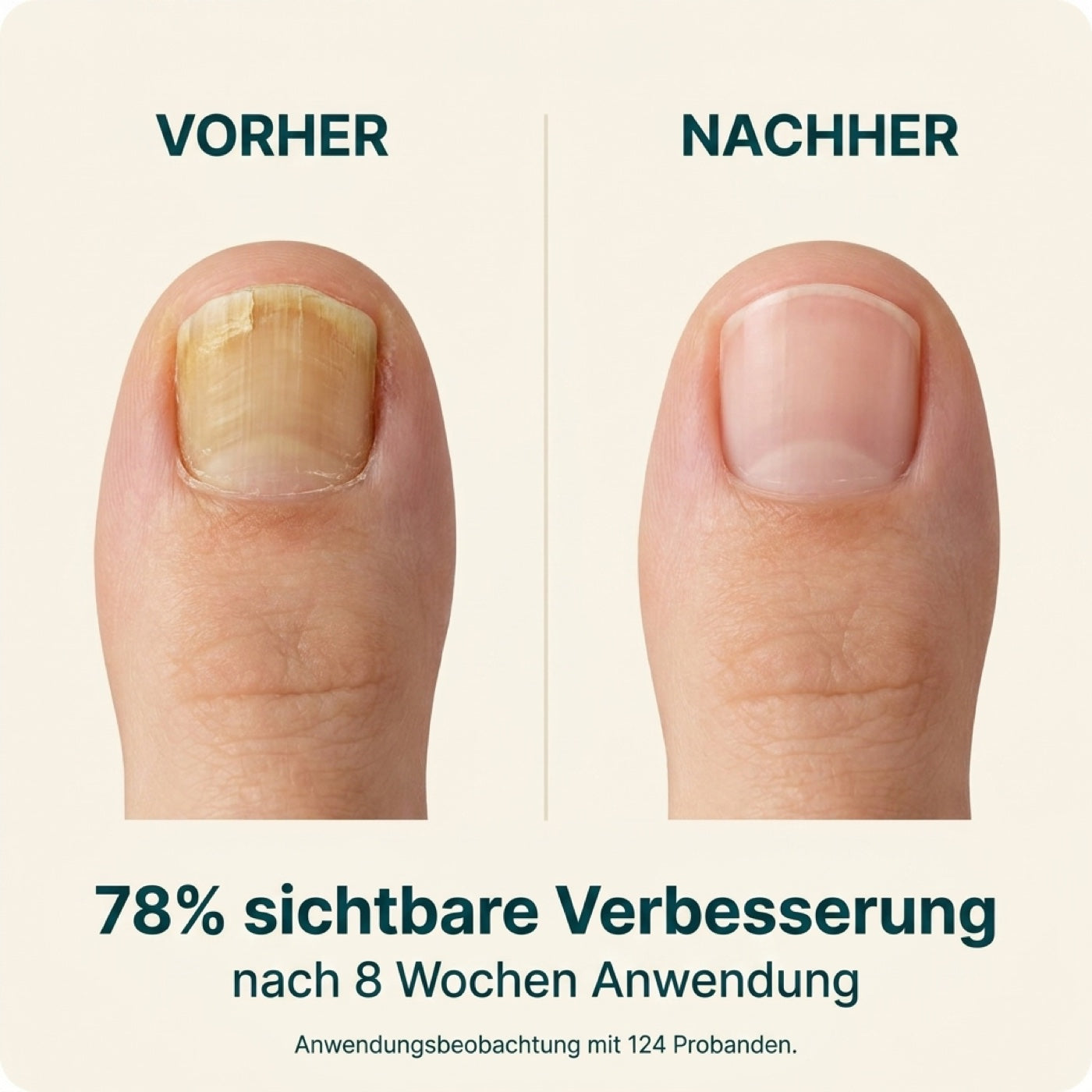124 Probanden · Anwendungsbeobachtung 2025